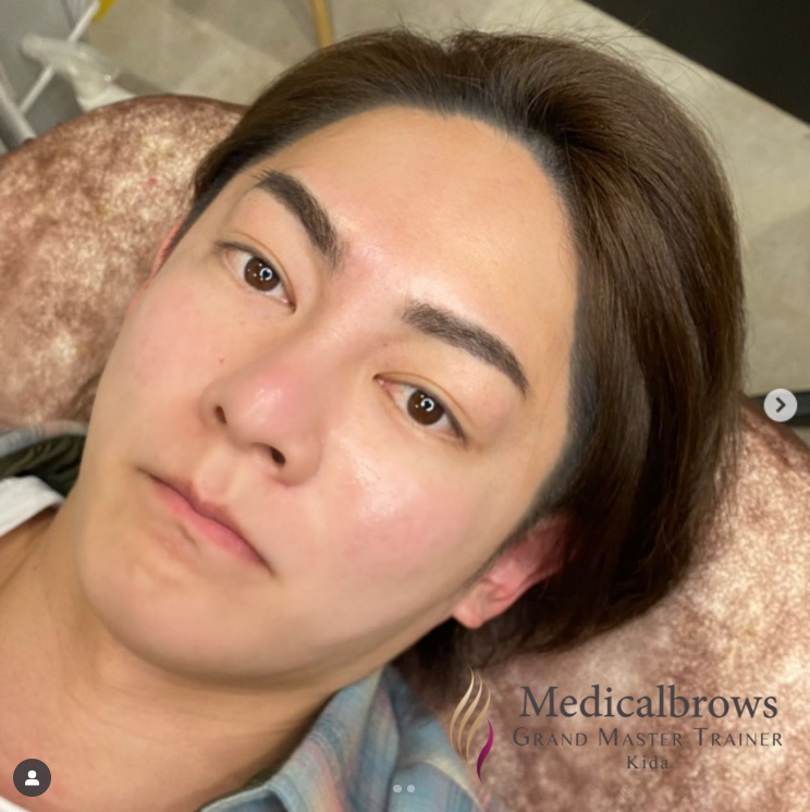 青汁王子さんの眉毛アートメイク写真