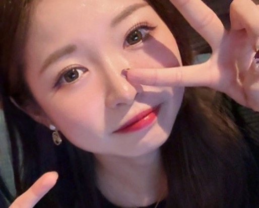 二重埋没一か月後の写真