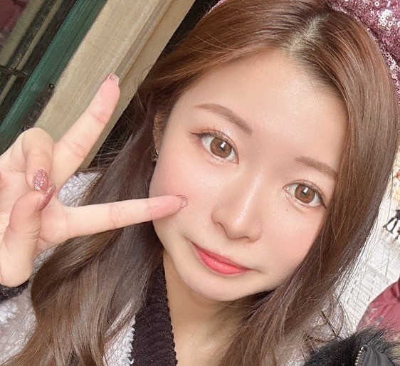 二重埋没6ヶ月以降の写真