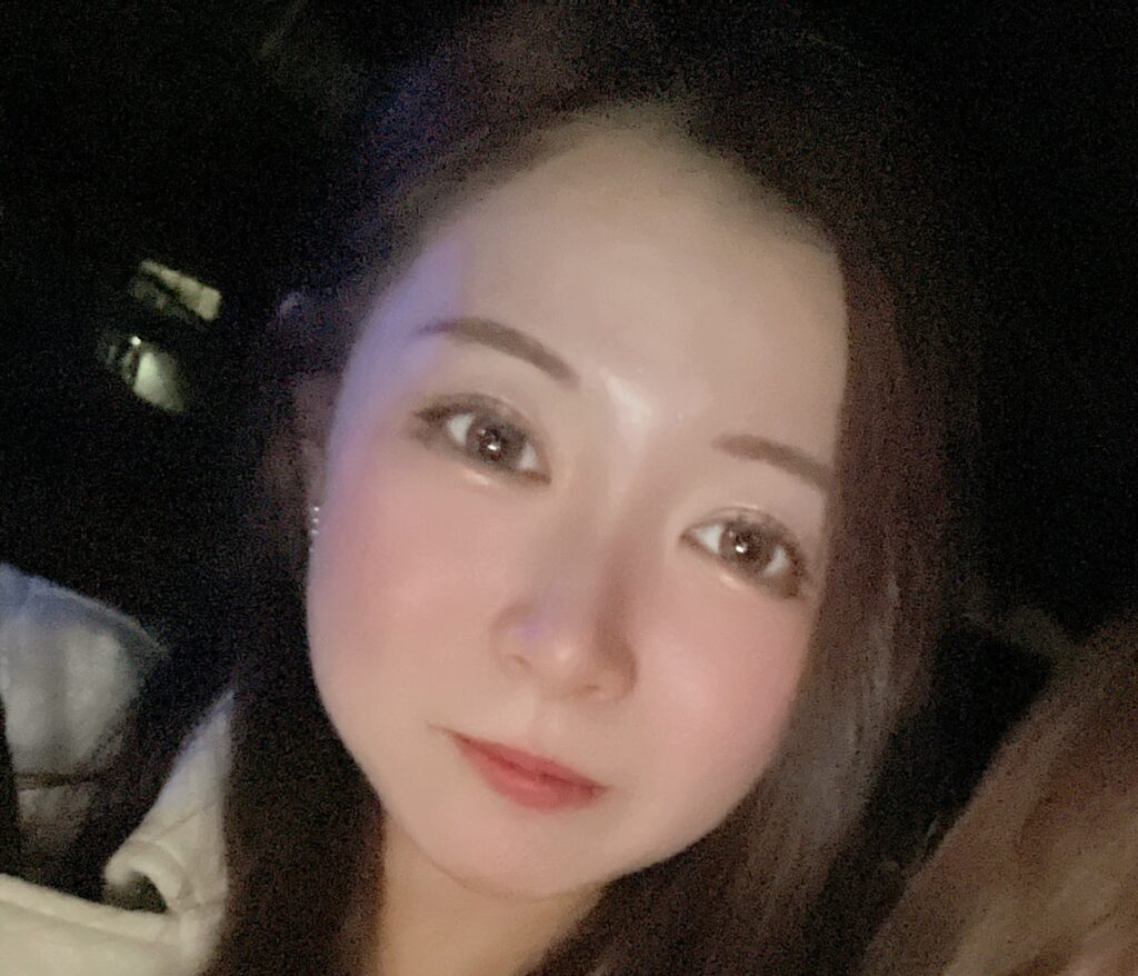 二重埋没1年6ヶ月後の写真