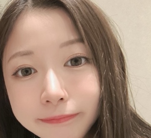 二重埋没一年後の写真