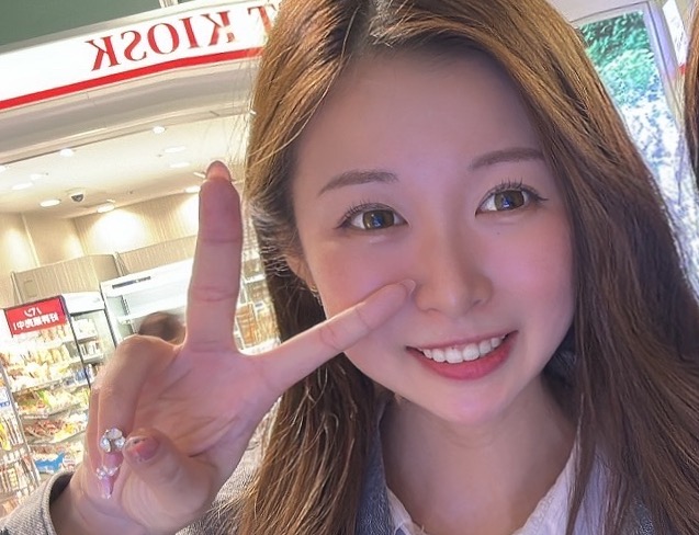 二重埋没2ヶ月後の写真
