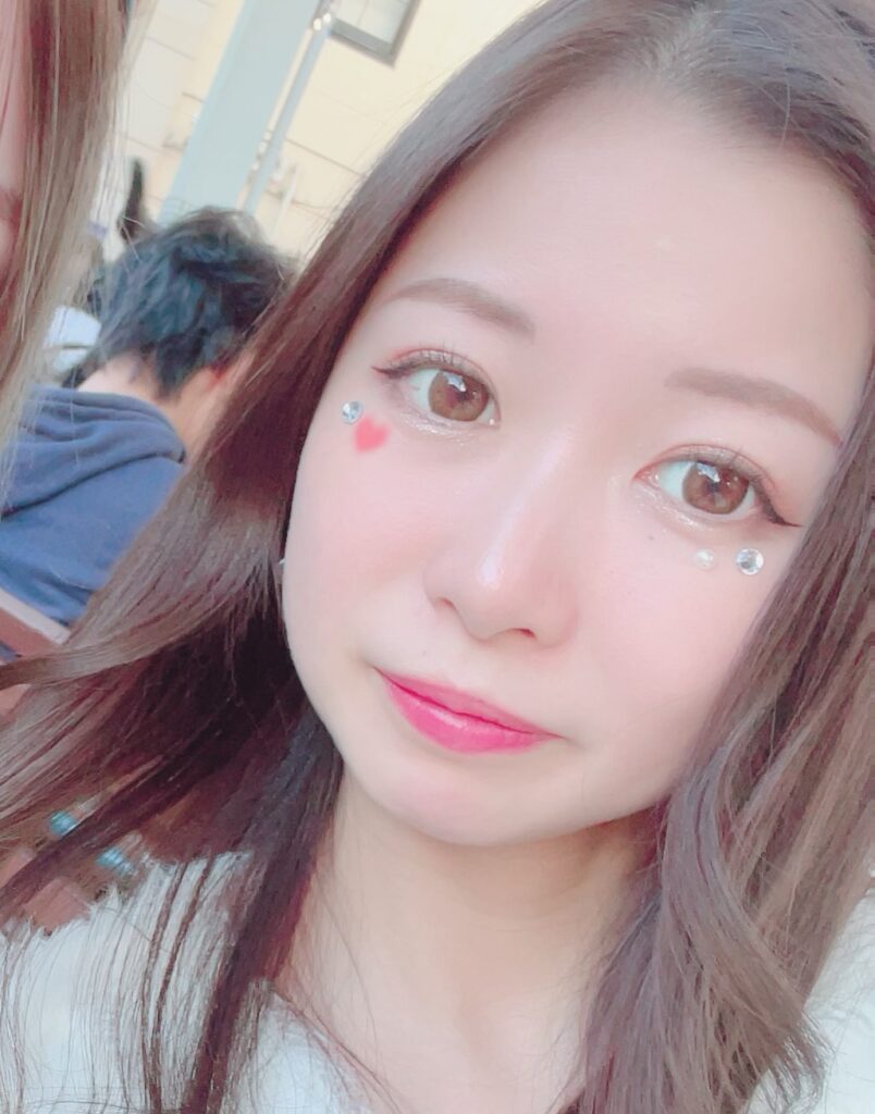 二重埋没1週間後の写真