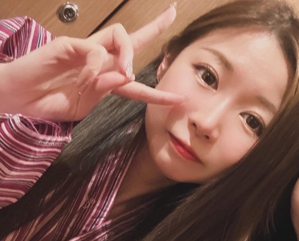 二重埋没2年後の写真