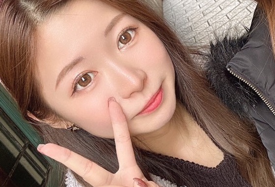 二重埋没2年後の写真