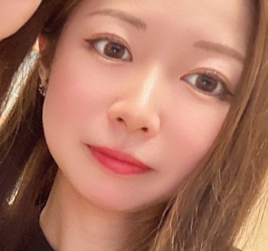 二重埋没3か月後の写真