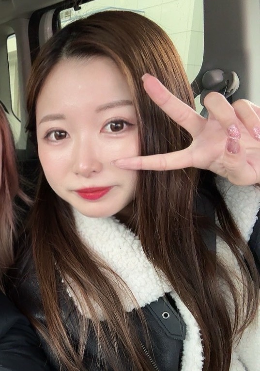 二重埋没2週間後の写真