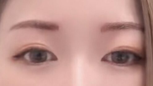 眉毛アートメイクのダウンタイム期間中の写真