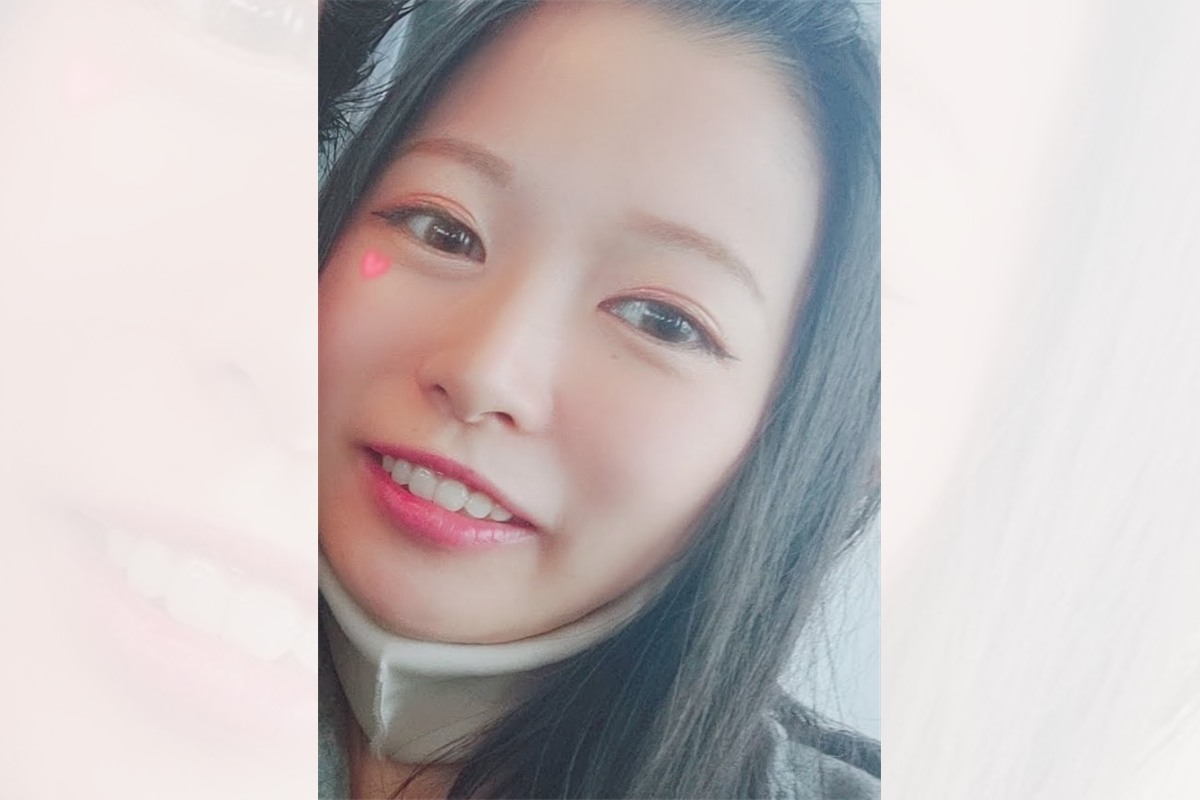 矯正後の歯並び