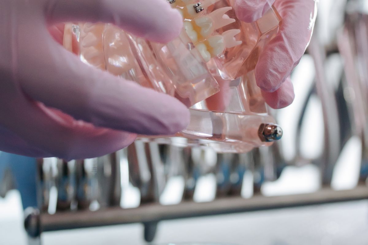姫路のマウスピース矯正