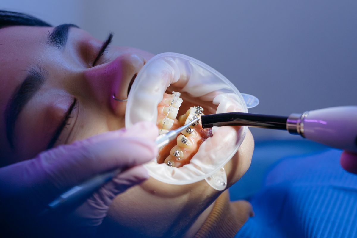 さいたまの矯正歯科のよくある質問